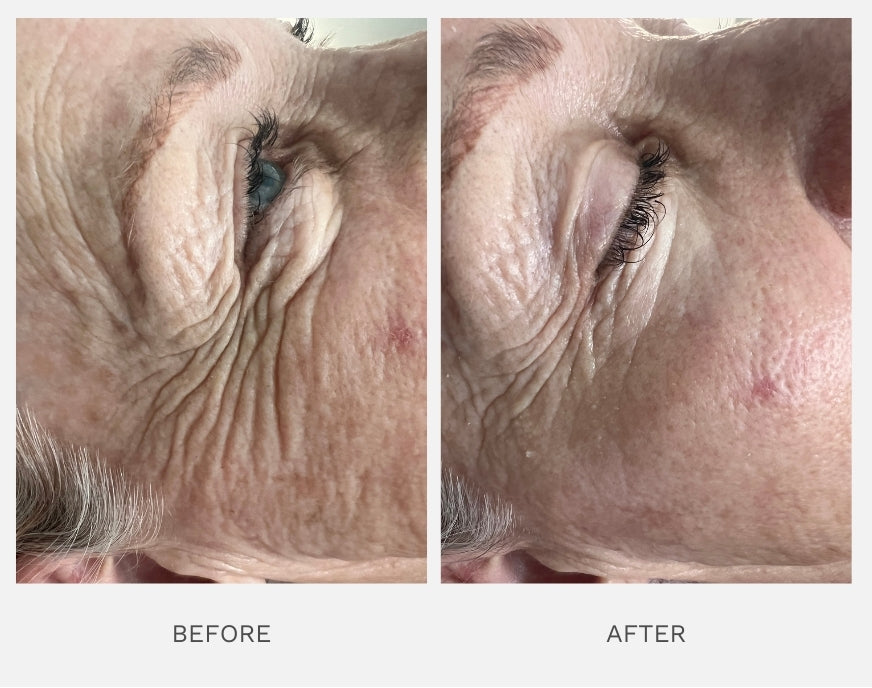 50+ | Age-Defying Luxe Bundle